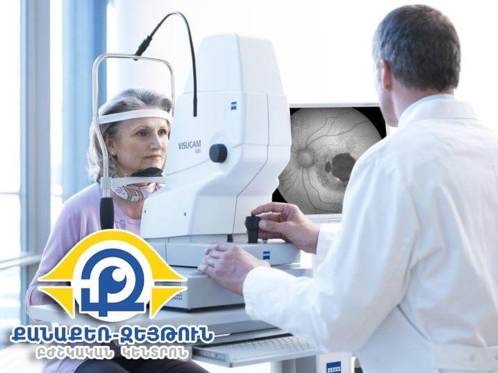 Ֆլյուորեսցեինային անգիոգրաֆիա